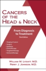 Image for Cancers of the Head and Neck