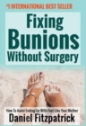 Image for Fixing Bunions Without Surgery