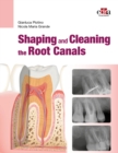 Image for Shaping and Cleaning the Root Canal System