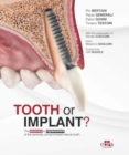 Image for Tooth or Implant