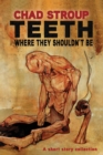 Image for Teeth Where They Shouldn&#39;t Be