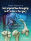 Image for Illustrated tips and tricks for intraoperative imaging in fracture surgery