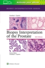 Image for Biopsy interpretation of the prostate