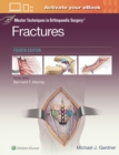 Image for Master Techniques in Orthopaedic Surgery: Fractures
