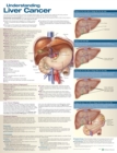 Image for Understanding Liver Cancer Anatomical Chart