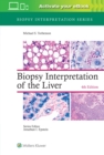 Image for Biopsy interpretation of the liver