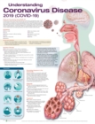 Image for Understanding Coronavirus Disease 2019 (COVID-19) Anatomical Chart