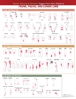 Image for Travell, Simons &amp; Simons’ Trigger Point Pain Patterns Wall Chart : Trunk, Pelvis, and Lower Limb