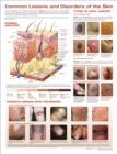 Image for Common Lesions and Disorders of the Skin Anatomical Chart
