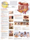Image for Understanding Skin Cancer Anatomical Chart