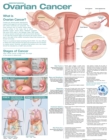 Image for Understanding Ovarian Cancer Anatomical Chart