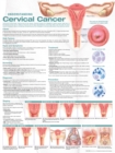 Image for Understanding Cervical Cancer Anatomical Chart