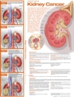 Image for Understanding Kidney Cancer Anatomical Chart