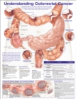 Image for Understanding Colorectal  Cancer Anatomical Chart