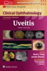 Image for Uveitis