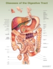 Image for Diseases of the Digestive Tract Anatomical Chart