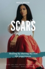 Image for Scars : Healing by sharing my own life experiences