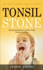 Image for Tonsil Stones