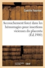 Image for Accouchement Force Dans Les Hemorragies Pour Insertions Vicieuses Du Placenta