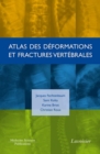 Image for Atlas des deformations et fractures vertebrales