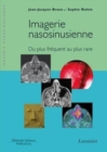 Image for Imagerie nasosinusienne [electronic resource] : du plus fréquent au plus rare / Jean-Jacques Braun, Sophie Riehm.