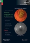 Image for Tumeurs Choroidiennes Et Retiniennes / Divers (Volume 8 - Coffret Retine)