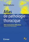 Image for Atlas De Pathologie Thoracique