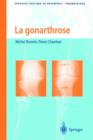 Image for La Gonarthrose : Traitement Chirurgical: de Larthroscopie a la Prothese