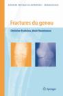Image for Fractures Du Genou