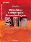 Image for Manifestations dermatologiques des maladies d&#39;organes