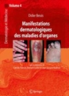 Image for Manifestations dermatologiques des maladies d&#39;organes: Dermatologie et medecine, Vol. 4