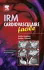 Image for IRM cardiovasculaire facile