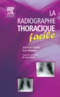 Image for La Radiographie Thoracique Facile