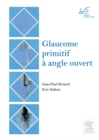 Image for Glaucome primitif a angle ouvert: Rapport SFO 2014