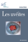 Image for Les uveites: Rapport SFO 2010