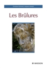 Image for Les brulures