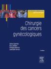 Image for Chirurgie des cancers gynecologiques