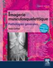 Image for Imagerie musculosquelettique : pathologies generales