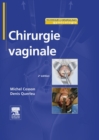 Image for Chirurgie vaginale