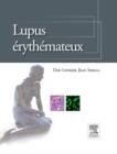 Image for Lupus erythemateux