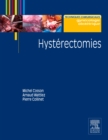 Image for Hysterectomies