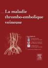 Image for La maladie thromboembolique veineuse