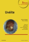 Image for Uveite
