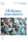 Image for Oedemes maculaires : 2016