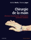 Image for Chirurgie de la main: Affections rhumatismales, degeneratives. Syndromes canalaires