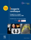 Image for Imagerie cardiaque