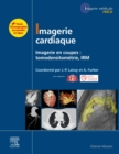 Image for Imagerie Cardiaque: Imagerie En Coupes : Scanner, IRM