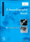 Image for Echocardiographie fotale