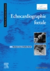 Image for Echocardiographie Foetale