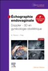 Image for Echographie endovaginale Doppler - 3D